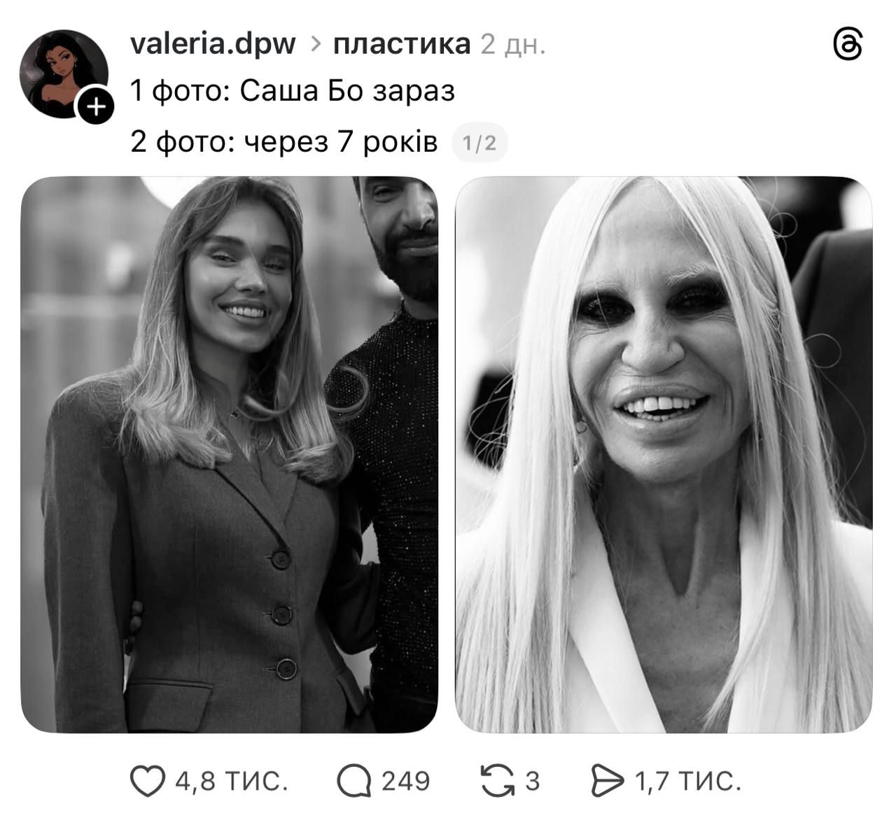 'Одно лицо с Козловским': Сашу Бо разнесли в сети из-за пластических операций - 804511 'Одно лицо с Козловским': Сашу Бо разнесли в сети из-за пластических операций - фото 804511