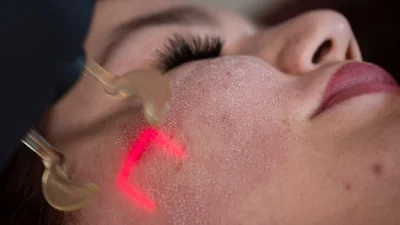 60 ожогов на лице: известная украинская актриса рассказала, как косметолог изуродовал ей лицо