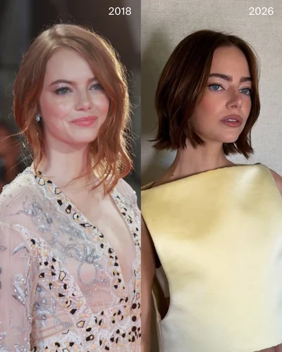 Емма Стоун до операцій та після - фото 820408