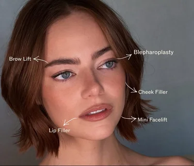 Які пластичні операції робила Емма Стоун? - фото 820409