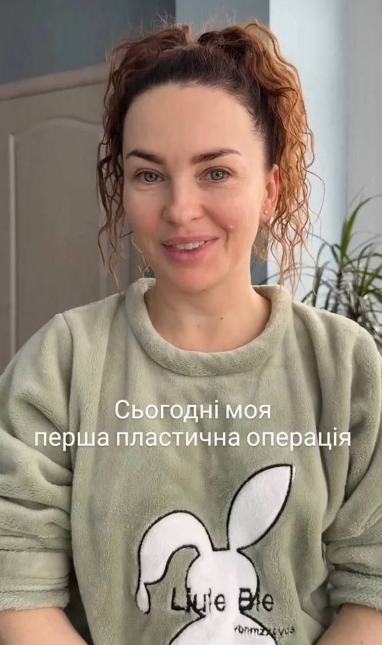 Виктория Булитко впервые сделала пластическую операцию и похвасталась результатом – фото - фото 822854