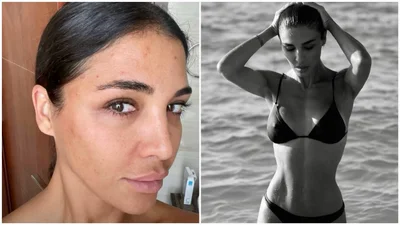 Санта Дімопулос показала свої фото з часів анорексії та булімії і розкрила болючу правду