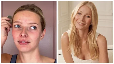 Дочь Гвинет Пэлтроу показала кожу с акне без фильтров и призналась в использовании филлеров