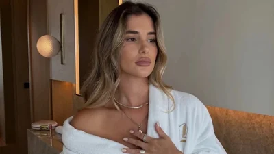 Без патчей и дорогих кремов: как быстро убрать отеки