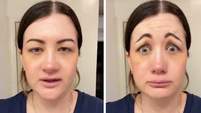 Неудачные косметические манипуляции превратили девушку в героиню из кошмаров - шокирующее видео