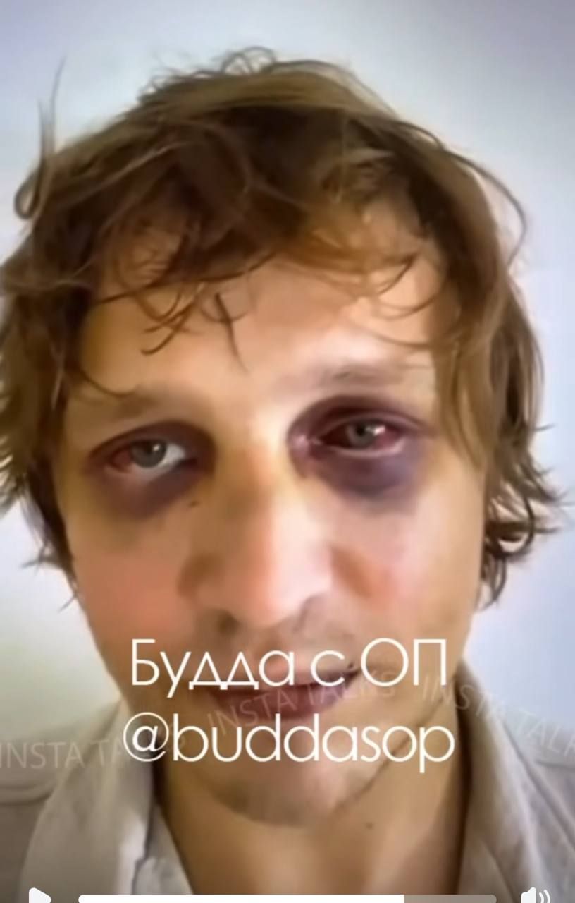 Над Ігоре жорстоко знущалися - 839118 Над Ігоре жорстоко знущалися - фото 839118