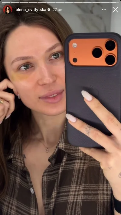 Олена Світлицька показала синець під оком - фото 839583