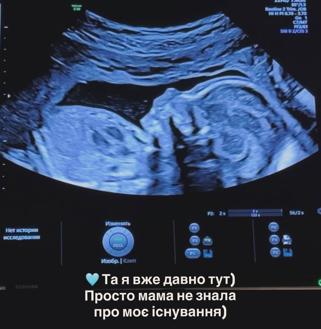 Як Анна Сагайдачна дізналася про третю вагітність - 839605 Як Анна Сагайдачна дізналася про третю вагітність - фото 839605
