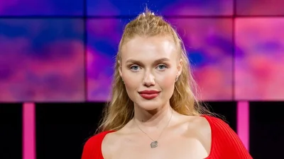 Фіналістка Холостяка показала, як облисіла через анорексію – фото до та після хвороби