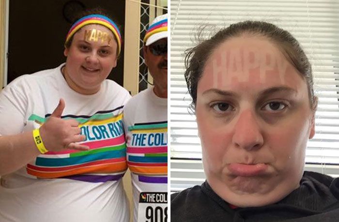Эти люди точно пожалели, что вышли на солнце без защитного крема - 843063 Эти люди точно пожалели, что вышли на солнце без защитного крема - фото 843063