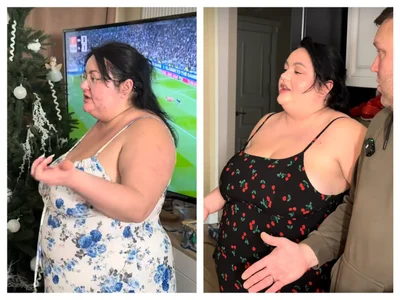 Настя Ткаченко та баріатрична операція - комікеса до хірургічного втручання - фото 844864