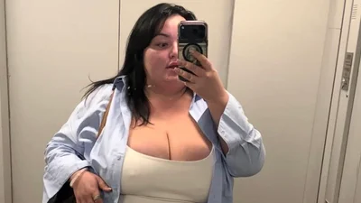 Настя Ткаченко після зменшення шлунку поскаржилая на свій раціон: "Усе, що я їм, - це вода"