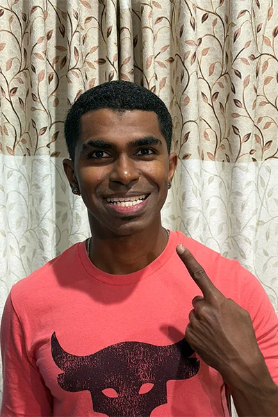 Цей чоловік має найбільшу кількість зубів у світі - на 10 більше, аніж зазвичай має людина - фото 847106