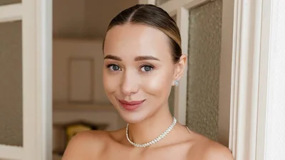 Катя Репяхова похвалилася результатами останньої пластики: "Підборіддя моєї мрії" - фото до та після