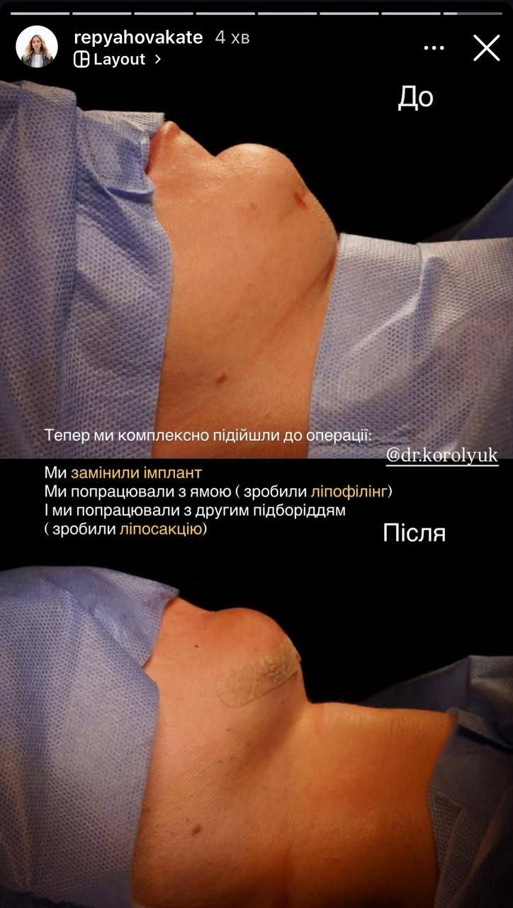 Катя Репяхова та підборіддя - 851448 Катя Репяхова та підборіддя - фото 851448