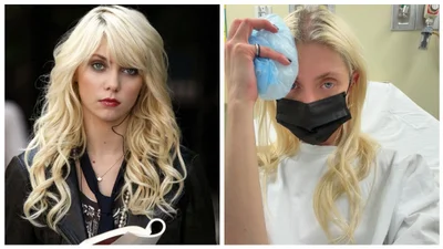 "Відкусив від мене шматочок": зірка "Пліткарки" загриміла в лікарню після нападу павука