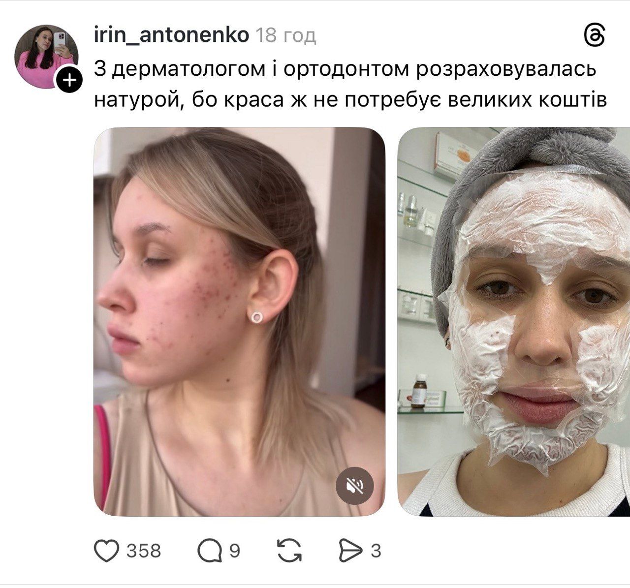 Злата Огнєвич та Катя Осадча - суперечка про гроші для краси - фото 861255