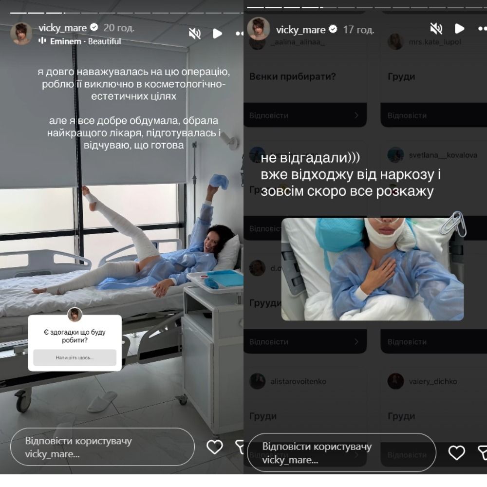 Виктория Маремуха сделала пластическую операцию на лице - что изменилось во внешности звезды - фото 866459