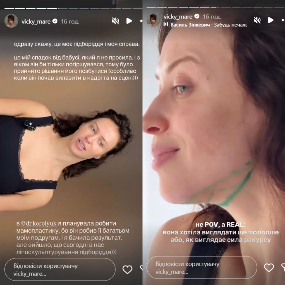 Виктория Маремуха сделала пластическую операцию на лице - что изменилось во внешности звезды - фото 866460