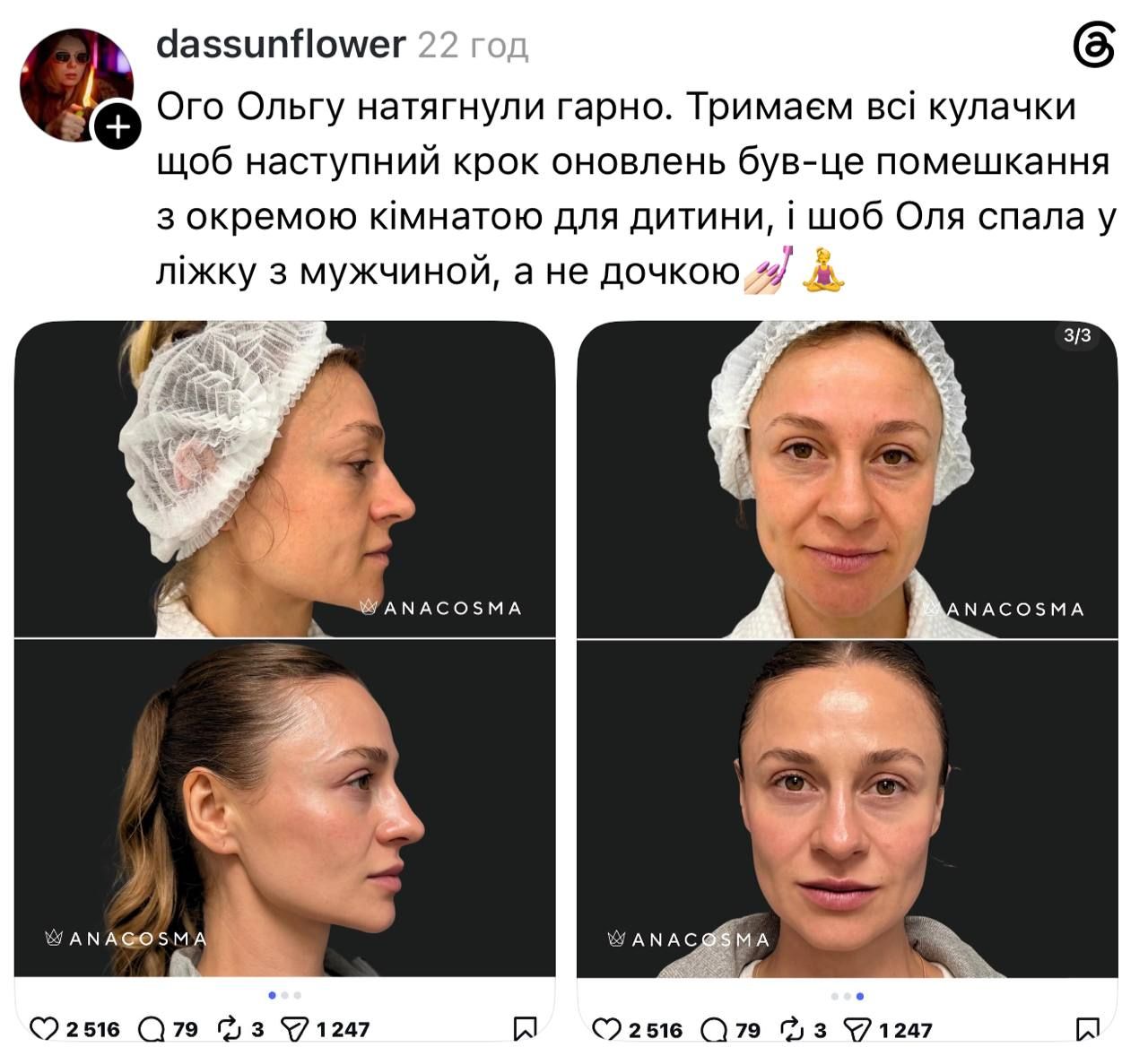 Допис 2 - 873415 Допис 2 - фото 873415