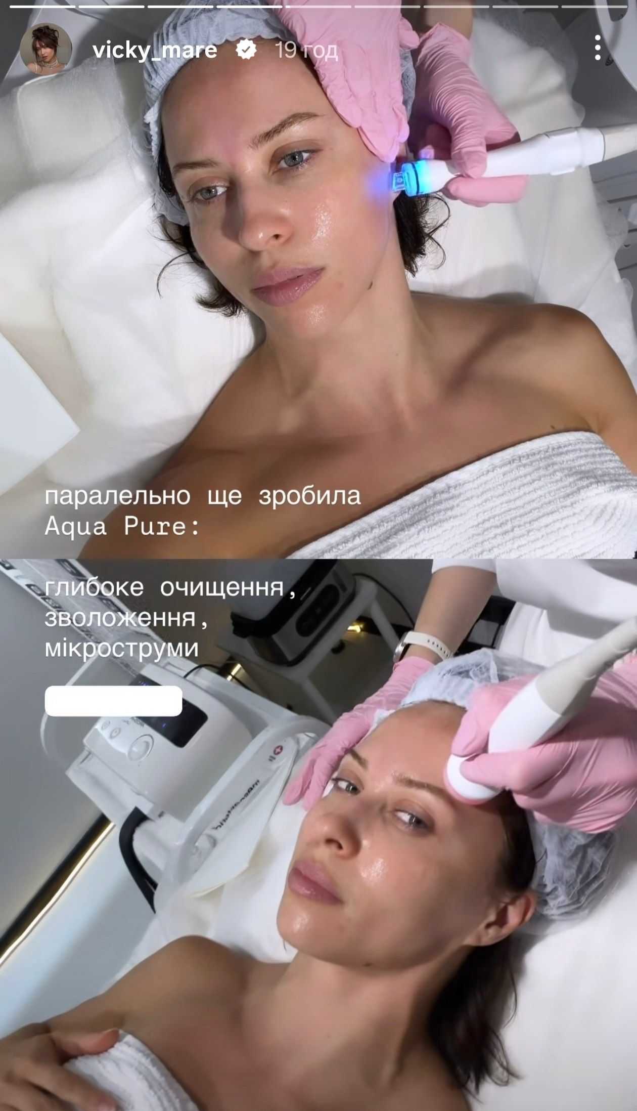 Вікторія Маремуха які процедури для обличчя робить - 885210 Вікторія Маремуха які процедури для обличчя робить - фото 885210