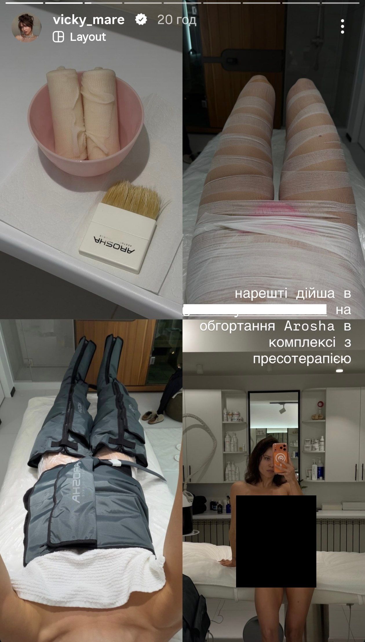 Вікторія Маремуха які процедури для тіла робить - 885211 Вікторія Маремуха які процедури для тіла робить - фото 885211