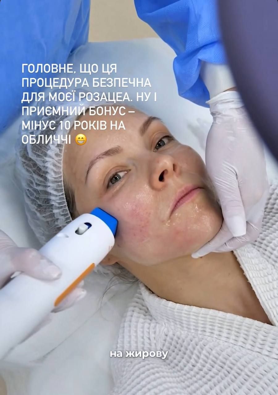 Олена Шоптенко робить процедуру для обличчя - 888414 Олена Шоптенко робить процедуру для обличчя - фото 888414