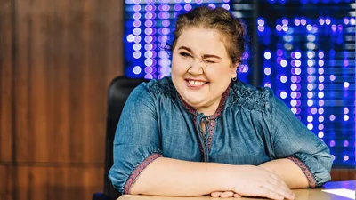 Звезда сериала "Киев днем и ночью" шокировала правдой о травме лица: "Ты как Сильвестр Сталлоне"