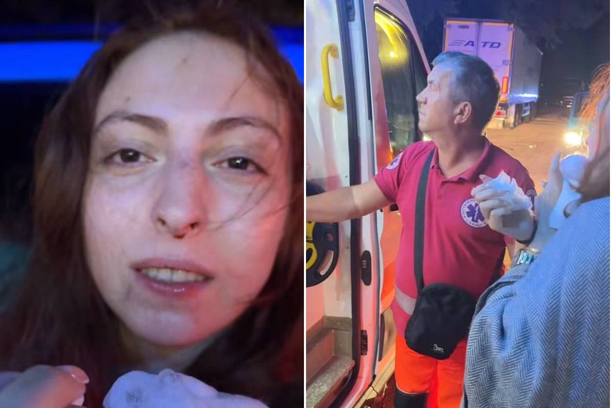 Маша Полякова зламала ніс у ДТП - 901516 Маша Полякова зламала ніс у ДТП - фото 901516