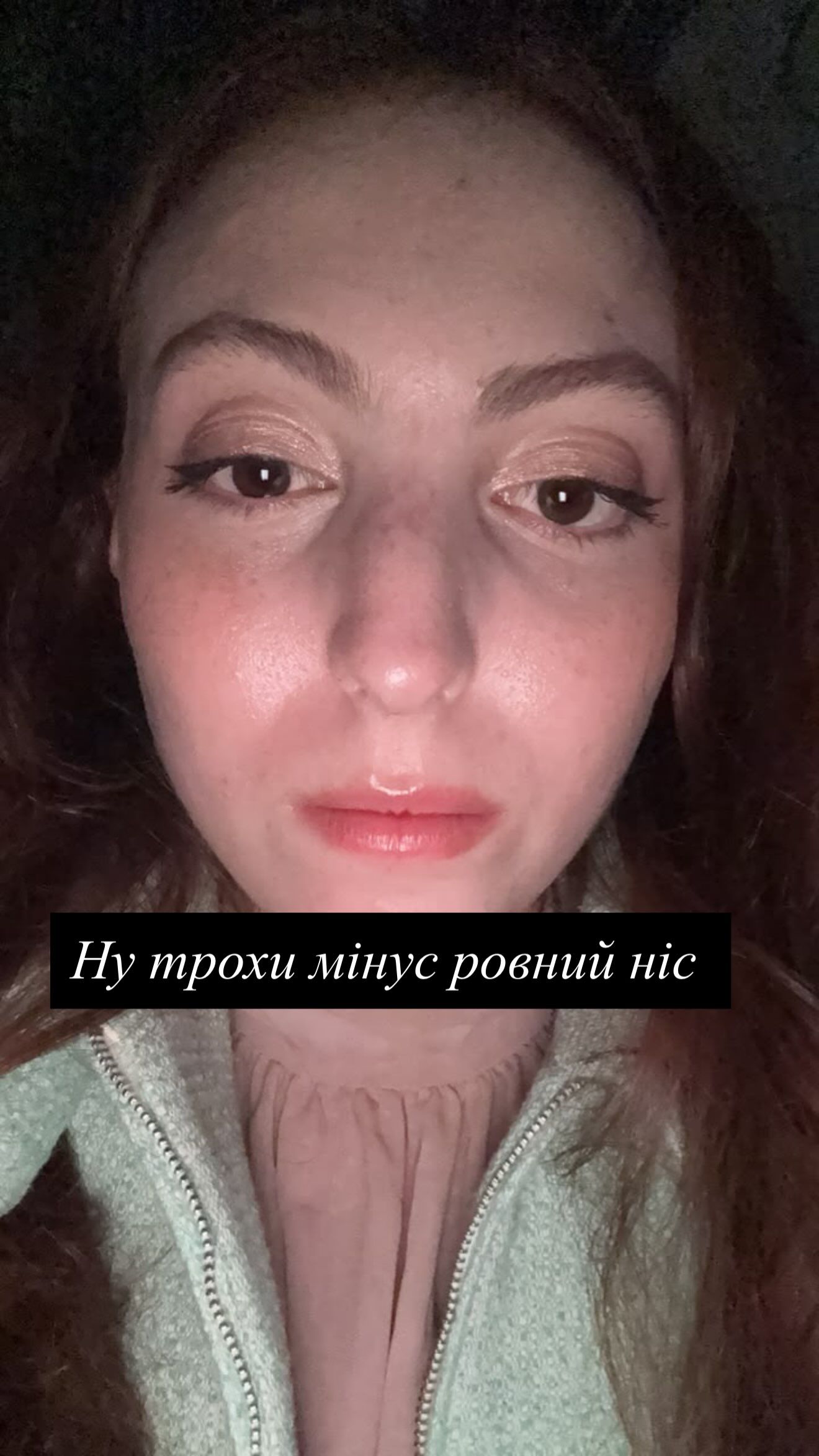 У Маші перелом носа - 902049 У Маші перелом носа - фото 902049