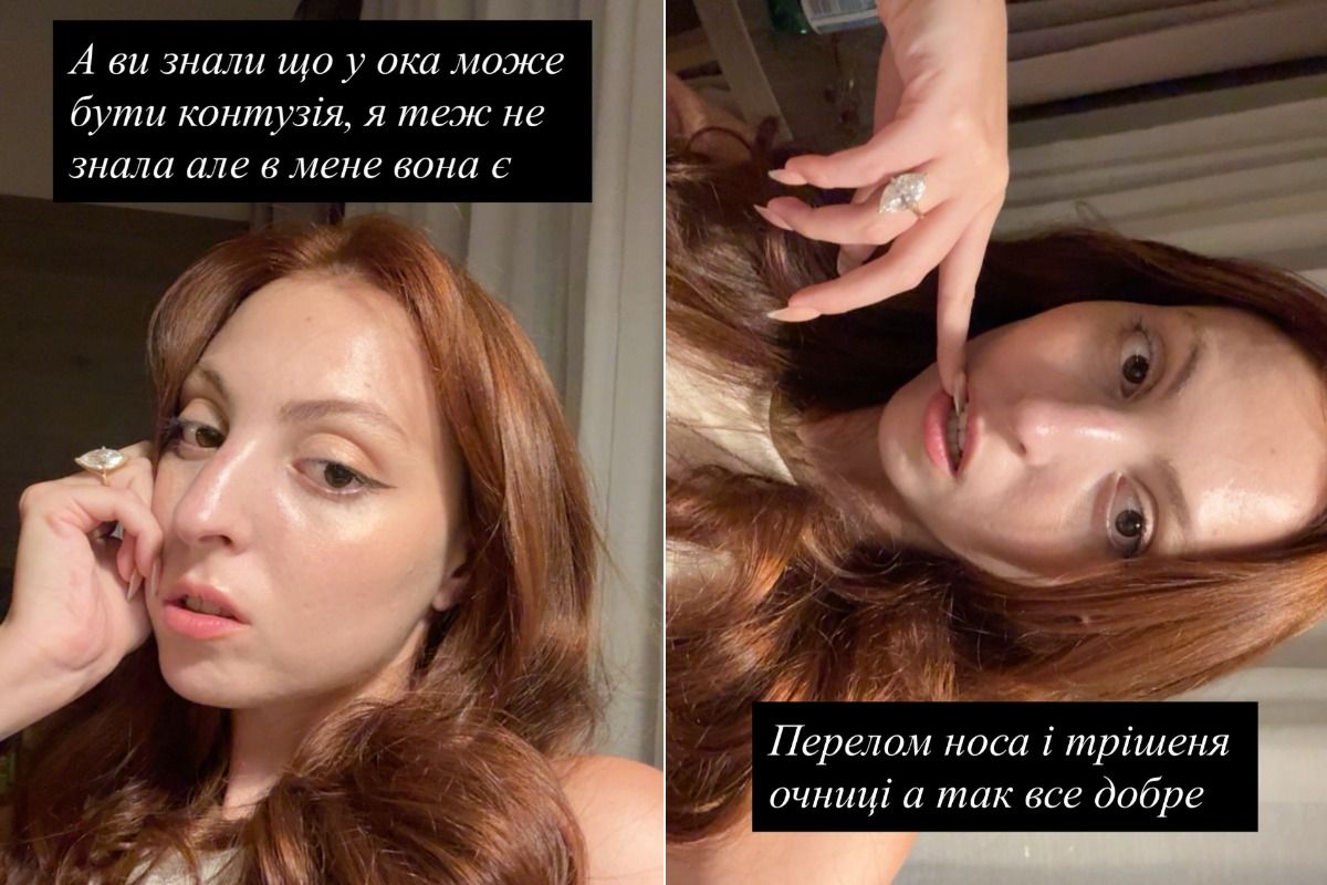 Маша Полякова розповіла про свій стан після ДТП - 902058 Маша Полякова розповіла про свій стан після ДТП - фото 902058