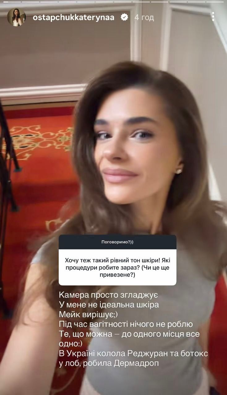 Катерина Остапчук коле ботокс з 25 років - фото 910575