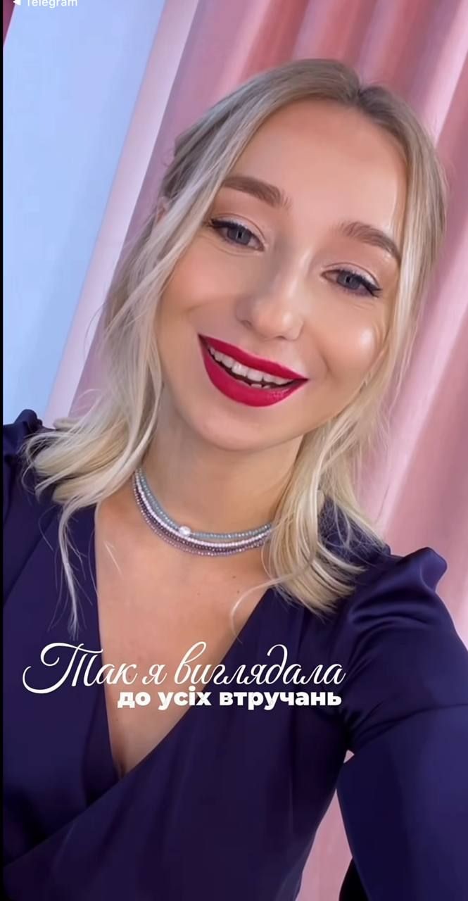 Катерина Репяхова до пластики - 918492 Катерина Репяхова до пластики - фото 918492