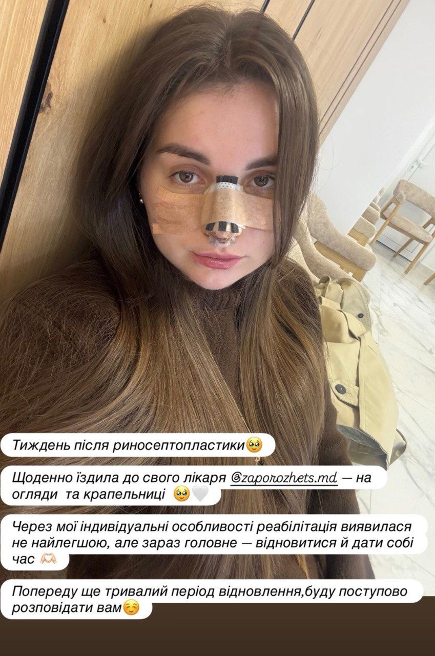 Барбара Кузьменко та пластика - фото 920341