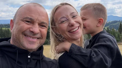 Дружина Павліка показала, як змінилося його обличчя після операції та кровотечі